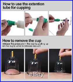 12 Cups Traditional Chinese Vacuum Suction Cupping Therapy Set Massage Cupping