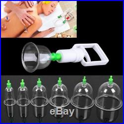 Effective Healthy 12 Cups Medical Vacuum Cupping Suction Therapy Device Set US K