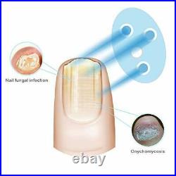 Nail Fungus Remover Repair Laser Device Toenail Therapy Onychomycosis Treatment